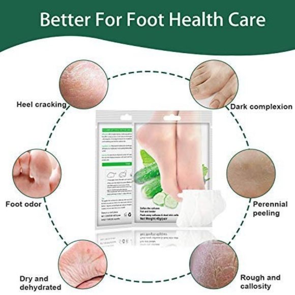 SEXROV American Quality Foot Peel Mask 2 Pack for Cracked Heels,Dead Skin & Call - Picture 2 of 7